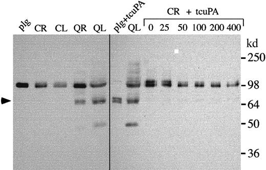 Fig. 7. Plasminogen in control and QPD platelets. / Proteins were analyzed by Western blotting with rabbit anti–human plasminogen after 10% reduced SDS-PAGE. Lanes compare 12 μL control (C) and QPD (Q) lysates (L) and ionophore releasates (R) and control ionophore releasate, incubated overnight with 0 to 400 ng/mL tcu-PA (CR + tcuPA), as indicated. As references, Glu-plasminogen (plg; 20 ng/lane) and the plasmin generated by digesting Glu-plasminogen (60 ng) with 100 ng/mL tcu-PA (plg + tcuPA) are shown. QPD platelets contained proteolyzed plasminogen that comigrated with the heavy chain of plasmin (arrow; the light chain of plasmin was not visualized by the antisera). They also contained correspondingly reduced proportions of intact plasminogen and some smaller proteolyzed components, not evident in normal platelets. When control platelet releasate was incubated with exogenous tcu-PA, there was a similar loss of intact plasminogen, but the extent of plasminogen proteolysis was not as complete as in QPD platelets.