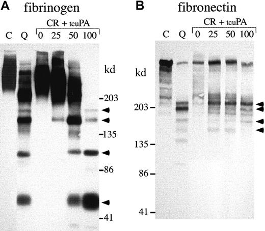 Fig. 8. α-granule fibrinogen and fibronectin degradation. / Western blots compare nonreduced fibrinogen (A; 5%-8% SDS-PAGE) and fibronectin (B; 4%-8% SDS-PAGE) in QPD (Q) and control (C) platelet lysates with the degradation products generated by incubating normal platelet ionophore releasate (CR) with 0, 25, 50, or 100 ng/mL tcu-PA (tcuPA), as indicated (volumes of releasate and lysates: A, 3.6 μL/lane; B, 15 μL/lane). When tcu-PA was incubated with normal platelet secretory proteins, α-granule fibrinogen and fibronectin were proteolyzed to forms that comigrated (arrows) with their degraded forms in QPD platelets.