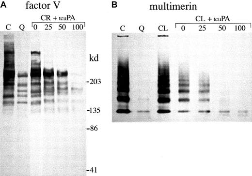 Fig. 10. α-granule factor V and multimerin degradation. / Western blots compare proteins in QPD (Q) and control (C) platelet lysates (samples with all inhibitors) with the forms generated by incubating normal platelet ionophore releasate (CR; A) or lysate (CL; B, lysate without serine protease inhibitors) with 0, 25, 50, or 100 ng/mL tcu-PA (tcuPA), as indicated. (A) When u-PA was incubated with normal platelet secretory proteins, α-granule factor V was degraded, resulting in a loss of factor V detectable by Western blotting with polyclonal antisera, as in QPD platelets (lanes compare 18 μL lysate and releasate, after reduced 4%-8% SDS-PAGE). (B) Although there was some loss of detectable multimerin in lysates incubated without tcu-PA, tcu-PA reduced the detectable multimerin, as in QPD platelets (lanes compare 15 μL lysates, separated on nonreduced multimer gels and probed with a mixture of monoclonal and polyclonal antimultimerin). Traces of degraded multimerin (bands below the smallest multimerin polymer in normal platelets) were evident in the u-PA digests (B) and in QPD platelets, with longer exposures (not shown).