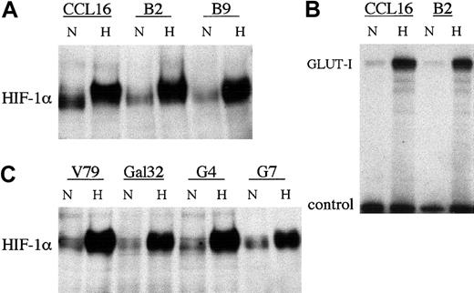Fig. 2. HIF-1α protein and HIF target gene expression in Chinese hamster fibroblast mutant cell lines. / (A,C) Immunoblots showing levels of HIF-1α protein in cell extracts from respiration-deficient Chinese hamster fibroblast mutant cell lines. Cells were cultured in parallel for 4 hours in normoxia (21% O2, N) or hypoxia (0.1% O2, H). (A) Chinese hamster lung fibroblast wild-type CCL16 cells and the derived CCL16-B2 (B2) and CCL16-B9 (B9) cell lines. (B) RNAse protection assay showing expression of Glut-1 mRNA in wild-type CCL16 and CCL16-B2 (B2) cells. Cells were cultured in parallel for 16 hours in normoxia (21% O2, N) or hypoxia (0.1% O2, H). Signals from Glut-1 mRNA and U6 small nuclear RNA, as an internal control, are indicated. (C) Chinese hamster lung fibroblast wild-type V79 cells and the derived Gal32, V79-G4 (G4), and V79-G7 (G7) cell lines.