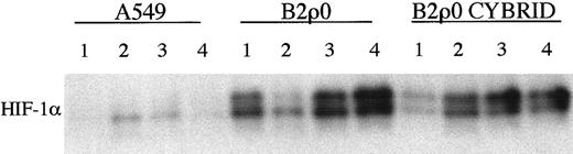 Fig. 4. HIF-1α protein expression in B2ρ0 cybrid cell line. / Immunoblot of HIF-1α protein levels in normoxic A549, B2ρ0, and B2ρ0 cybrid cell lines. Cybrid cell line harbors mitochondria with 100% wild-type mtDNA and is restored to respiratory competence. Four independent sets of whole cell extracts 1 to 4 were assayed.