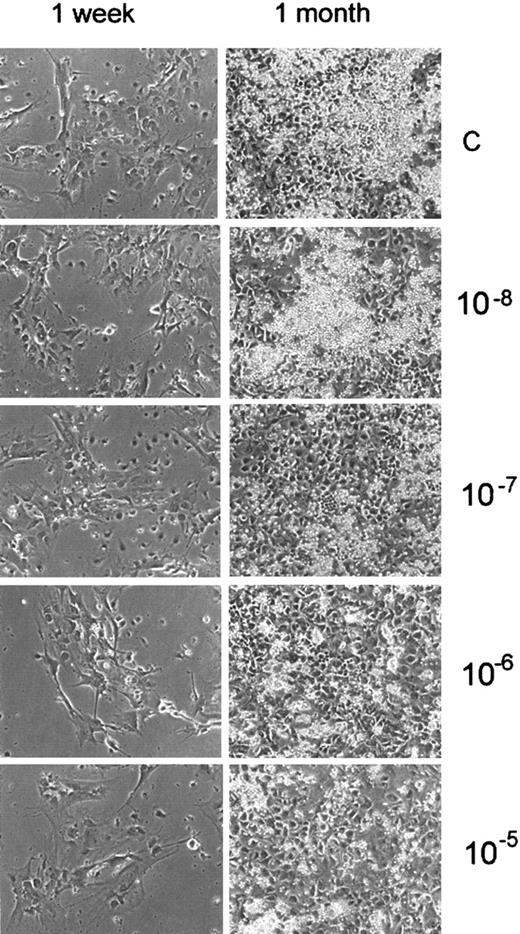 Fig. 3. Nicotine inhibits the formation of “cobblestone areas” in LTBMCs. / LTBMCs were treated with different concentrations of nicotine (10−5 to 10−8 M). Nicotine was added to the culture medium weekly during feedings, starting from day 0. Formation of the adherent layer was monitored under an inverted microscope. Photographs were taken after 1 week and 1 month of culture.