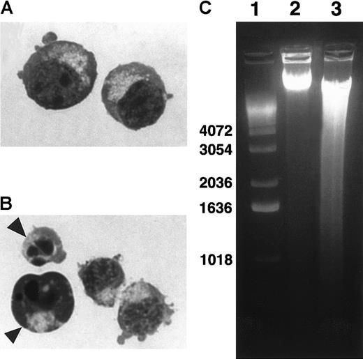 Fig. 3. Apoptotic morphology and DNA fragmentation of ECFCs incubated with nRCAS1. / Day 7 ECFCs were incubated for 24 hours at 37°C in liquid media with 15% FCS, 15% human AB serum, rhSCF (20 ng/mL) and rhEPO (2 U/mL) with, or without nRCAS1. Then, cytospin specimens of the cells were prepared and stained with May-Giemsa. (A) Immature erythroid cells after liquid culture without nRCAS1. (B) Apoptotic cells after liquid culture with nRCAS1. (C) DNA samples were isolated from day 7 ECFCs incubated with, or without nRCAS1 for 24 hours. DNA fragmentation of ECFCs exposed to RCAS1 was shown by neutral pH and 1.6% agarose gel electrophoresis, and stained with 0.5% ethidium bromide. Lane 1 displays size markers; lane 2 displays control cultures with rhEPO (2 U/mL), but without nRCAS1; lane 3 displays cultures with rhEPO plus nRCAS1.