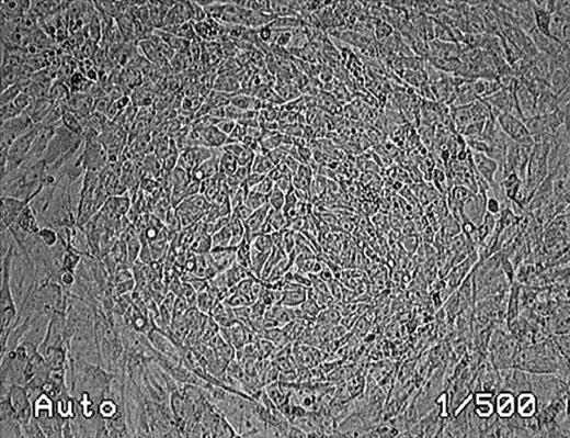 Fig. 1. Phase-contrast photomicrograph of an undifferentiated rhesus monkey ES cell colony (magnification, ×100).