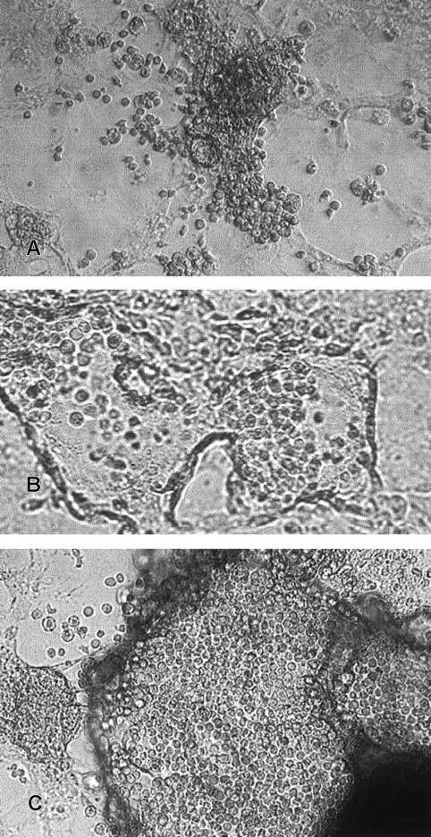 Fig. 2. Phase-contrast photomicrographs of hematopoietic-like clusters from differentiated ES colonies. / (A) A hematopoietic-like cluster (magnification, ×100). (B) A hematopoietic-like cluster showing morphologic characteristics similar to an embryonic blood island (magnification, ×100). (C) A hematopoietic-like cluster induced by BMP-4 (magnification, ×100).