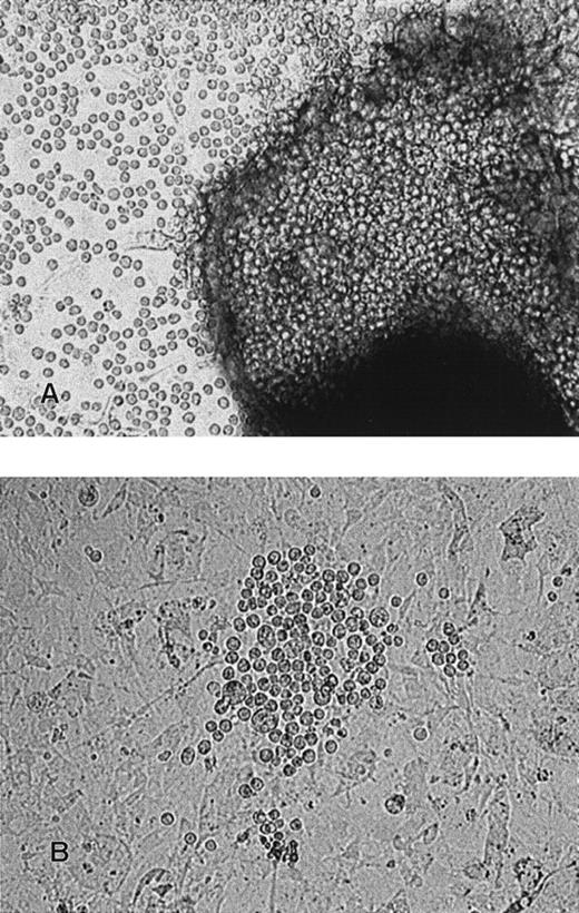 Fig. 3. Phase-contrast photomicrographs of expanded hematopoietic-like clusters from differentiated ES colonies. / (A) A cluster expanded with cytokines (magnification, ×100). (B) A migrated CAFC in primary differentiation culture (magnification, ×100).