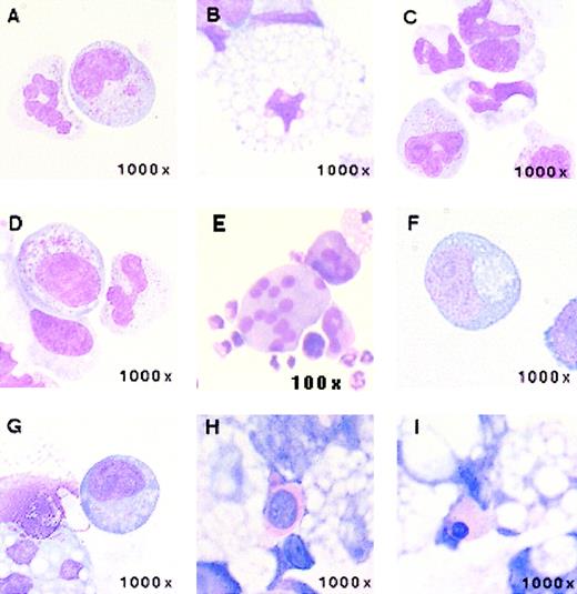 Fig. 4. Photomicrographs of hematopoietic progeny cells derived from differentiated rhesus monkey ES colonies. / (A) Granulocyte and monocyte. (B) Macrophage. (C,D) Granulocytes. (E) Megakaryocyte. (F,G) Immature blast cells. (H,I) Erythroblasts.