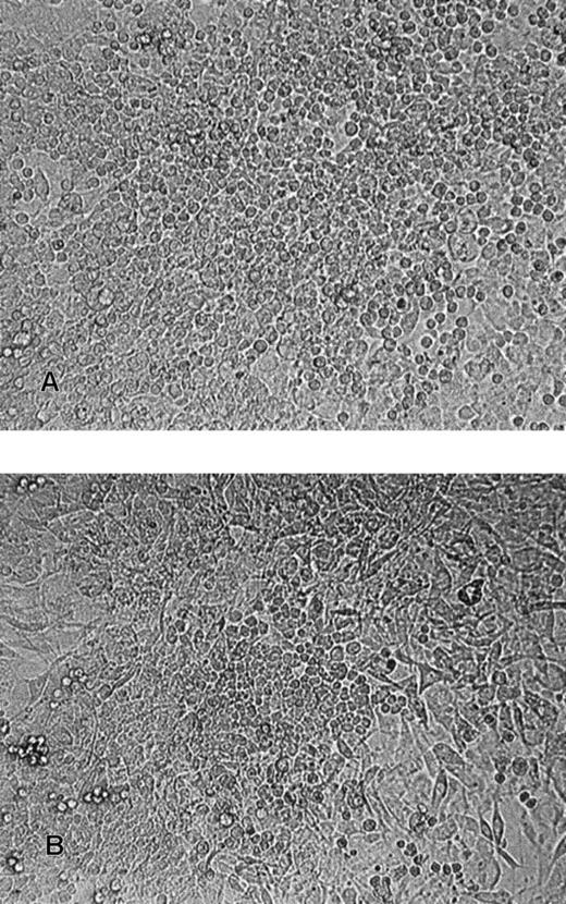Fig. 5. Phase-contrast photomicrographs of replated CAFC colonies from differentiated ES cells. / (A) Secondary CAFC colony (magnification, ×100). (B) Tertiary CAFC colony (magnification, ×100).