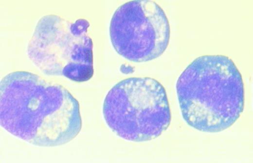 Fig. 8. Photomicrograph of sorted CD34+ cells from differentiated rhesus monkey ES colonies. / Cell populations of medium and small size were gated. CD34+cells with bright fluorescence intensity were sorted and stained with Wright-Giemsa stain after cytospin preparation (magnification, ×1000).