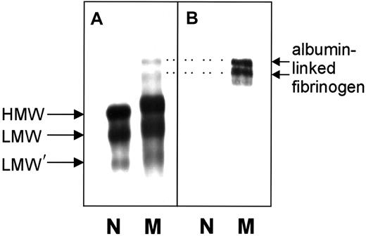 Fig. 3. Immunoblots of unreduced normal fibrinogen and of fibrinogen Milano XII. / (A) Detection with anti–human fibrinogen antibodies. (B) Detection with anti–human serum albumin antibodies. N, normal fibrinogen; M, fibrinogen Milano XII; HMW, high-molecular-weight fibrinogen (340 kd); LMW, low-molecular-weight fibrinogen (305 kd); LMW′, low-molecular-weight fibrinogen (270 kd). Amount of fibrinogen loaded: panel A, 0.44 μg; panel B, 2.4 μg. Dotted lines connect the albumin-linked bands in panel B with their counterparts in panel A.