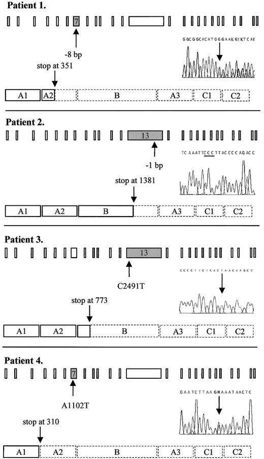 Fig. 1. Predicted truncated FV molecules as encoded by the FV frameshift and nonsense mutations detected in this study. / Schematic representation shows the 25 exons of the FV gene and the procoagulant protein that consists of a heavy chain (A1-A2), a connecting region or B domain, and a light chain (A3-C1-C2). The position of the mutation in the gene and in the DNA sequencing electropherogram as well as the predicted premature translation stop in the protein are indicated by arrows. The 3 cytosines resulting from the 1-bp deletion in patient 2 are underlined. Dashed lines in the protein indicate the part that is lacking, as compared to the wild-type protein. Patient 1: heterozygous 8-bp deletion between nts 1130 and 1139 in exon 7 leading to a premature stop at codon 351. Patient 2: homozygous 1-bp deletion between nts 4291 and 4294 in exon 13 leading to a premature stop at codon 1381. Patient 3: homozygous C→T nonsense mutation at nt 2491 in exon 13, changing the codon for glutamine at residue 773 into a stop codon. Patient 4: heterozygous A→T nonsense mutation at nt 1102 in exon 7, changing the codon for lysine at residue 310 into a stop codon. W: A or T