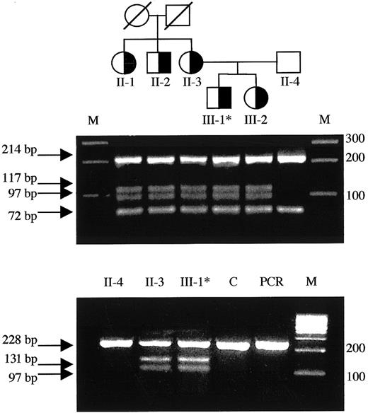 Fig. 2. Detection of the T1927C missense mutation in the family pedigree and mutant RNA. / (Top) Family pedigree: individuals heterozygous for the T1927C (FV Nijkerk) missense mutation are indicated by a half-closed symbol. (Middle) Exon 12 was amplified from genomic DNA and subjected toBsl I digestion as described. The mutation creates an additional restriction site and the resulting fragments are indicated by arrows. Each lane represents the DNA from the individuals located directly above in the family pedigree in the top panel. (Bottom) Total RNA was reverse transcribed and amplified as described. SubsequentBsl I digestion revealed the presence of both the wild-type allele as well as the mutant allele in the RNA of patient 5 (III-1) and his mother (II-3). Asterisk indicates propositus; M, marker; C, liver tissue32 RNA control; PCR, uncut RT-PCR product (247 bp).