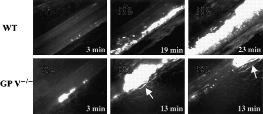 Fig. 2. Characteristics of thrombus growth differ between wild-type and GP V−/− mice. / Times after FeCl3-induced injury are indicated (min). In the wild-type arteriole, adherent fluorescently labeled platelets can be seen 3 minutes after FeCl3 treatment. A stable thrombus, present at 19 minutes, caused vessel occlusion at 23 minutes after injury. In GP V−/− mice, the occurrences of platelet-vessel wall interactions and platelet aggregation were accelerated. Good size thrombi were seen as early as 3 minutes after injury. However, these thrombi were not stable. They were often stripped off the vessel wall by blood flow when they grew to occlusive size (2 sequential panels at 13 minutes) and led to a significant number of downstream occlusions. The arrows point to a moving thrombus.