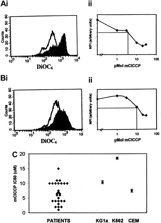 Fig. 4. Sensitivity of AML blasts to mitochondrial membrane depolarization induced by mClCCP. / Each dose was assayed in triplicate. (Ai and Bi) Flow cytometric histograms for DiOC6 fluorescence at 10 μM mClCCP (unshaded histogram) and untreated control (shaded histogram). Ai illustrates a sensitive sample, and the corresponding dose-response curve is shown in Aii. Bi illustrates a resistant sample, and the corresponding dose-response curve is shown in plot Bii. The horizontal line markers on the dose-response curves indicate 50th percentile fluorescence, and the perpendicular lines indicate the mClCCP IC50. (C) Summary scatterplot showing the mClCCP IC50 for 27 samples from patients with AML and the CEM C7H2, KG1a, and K562 leukemic cell lines. The cell line data include error bars (± SEM) derived from at least 3 separate experiments.