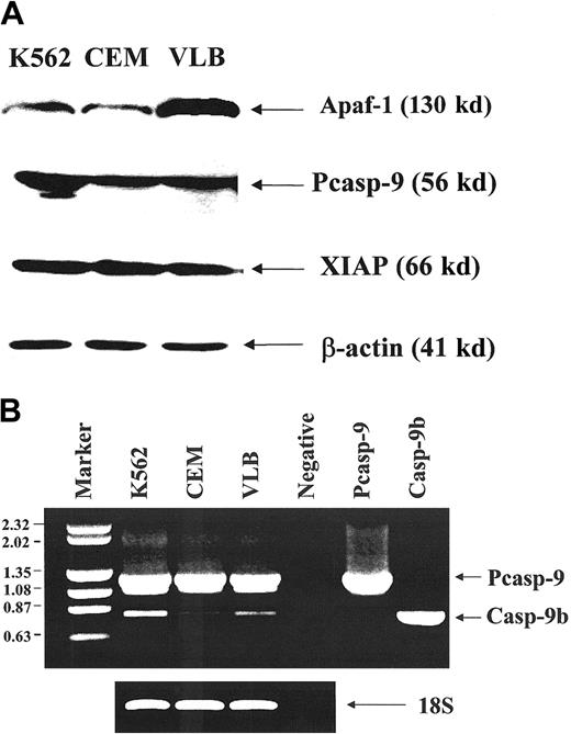 Fig. 3. Expression of Apaf-1, procaspase-9, and XIAP in leukemic cell lines. / (A) Western blot analysis of the expression of Apaf-1, procaspase-9, and XIAP protein. Two hundred micrograms of protein was used for Apaf-1 expression. Monoclonal anti–Apaf-1 antibody5 was used at 1:1000 dilution. The ratio K562:CEM:CEM/VLB100 for Apaf-1 expression was 1:1:3. 50 μg protein was used for procaspase-9 expression. Monoclonal anti–caspase-9 antibody5 was used at 1:1000 dilution. The ratio K562:CEM:CEM/VLB100 for procaspase-9 expression was 2:1:1. 25 μg protein was used for XIAP expression and detected by polyclonal anti-XIAP antibody and was used at 1:1000 dilution. The ratio K562:CEM:CEM/VLB100 for XIAP expression was 1:1.2:1. (B) RT-PCR analysis of the expression of procaspase-9 and caspase-9b. (left) DNA size markers (kb); right, 2 caspase-9 isoforms (procaspase-9 1.2 kb; caspase-9b, 0.8 kb).