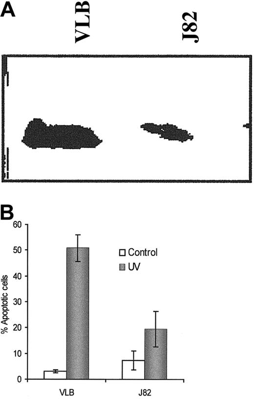 Fig. 10. Apaf-1 expression and the sensitivity to UV light–induced apoptosis in the human bladder cancer J82 cells. / (A) Apaf-1 expression in J82 cells and compared with CEM/VLB100 cells. (B) UV light–induced apoptosis in the J82 cell line and compared with the CEM/VLB100 cell line. Apoptosis was measured by flow cytometer using propidium iodide–stained cells after exposure to UV light for 8 hours.
