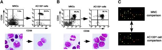 Fig. 2. Comparison of MNC and BAMP screening for healthy volunteers and a patient with MDS. / (A) MNCs isolated from the PB of healthy volunteers were subjected to anti-AC133 affinity chromatography, followed by fluorescence-activated cell sorting with anti-AC133. The eluted (AC133+) cells and the original MNCs were analyzed for surface expression of CD34 and CD38 by flow cytometry (upper panels). The percentage of CD34+cells in each sample is indicated. Wright-Giemsa staining of each cell preparation is also shown (lower panels, original magnification ×100). (B) Purification of AC133+ cells from a patient with MDS-associated leukemia. MNCs isolated from the PB of the patient (ID no. 7) were subjected to anti-AC133 affinity chromatography. The MNCs and AC133+ cells were then analyzed for surface expression of CD34 and CD38 and subjected to Wright-Giemsa staining as described for panel A, original magnification ×100. (C) Total RNA isolated from the MNCs of healthy volunteers and the patient with MDS was used to synthesize cDNA labeled with Cy5 and Cy3 dyes, respectively. A mixture of the labeled cDNA preparations was then subjected to hybridization with a cDNA microarray containing fragments of 382 cancer-related genes (upper panel). Red and green spots thus indicate genes specifically expressed in the healthy volunteers or in the patient, respectively; yellow spots correspond to genes expressed to similar extents in both samples. RNA prepared from purified AC133+ cells of the healthy volunteers and the patient was similarly analyzed (lower panel). A part of the scanned image is demonstrated. Some spots, including those numbered, exhibited opposite patterns of expression by MNC screening and BAMP screening.