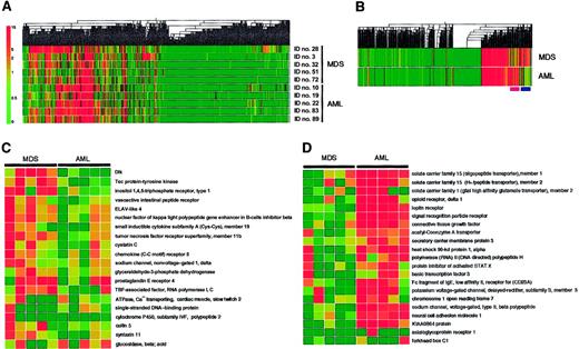Fig. 3. Expression profiles of 2304 genes in the MDS and AML blasts. / (A) Hierarchical clustering of 2304 genes based on their expression profiles in Blast Bank samples of individuals with AML or MDS. Each column represents a single gene on the microarray, and each row a separate patient sample. The fluorescence intensity of each gene was normalized by the mean fluorescence value of spots in each hybridization, and is shown color-coded as indicated on the left. Gray indicates the data of blank spots. (B) Mean expression values for each gene were calculated for MDS and AML samples and used to generate a dendrogram. The positions of the clusters of MDS-specific genes and AML-specific genes are indicated at the bottom by pink and purple bars, respectively. (C) Expression profiles of MDS-specific genes. Each row corresponds to a single gene, with the columns indicating the corresponding expression level in different samples. (D) Expression profiles of AML-specific genes. The gene names and accession numbers as well as expression intensity data for the genes shown in panels C and D are available on request. ELAV indicates embryonic lethal, abnormal vision; TBP, TATA box-binding protein.