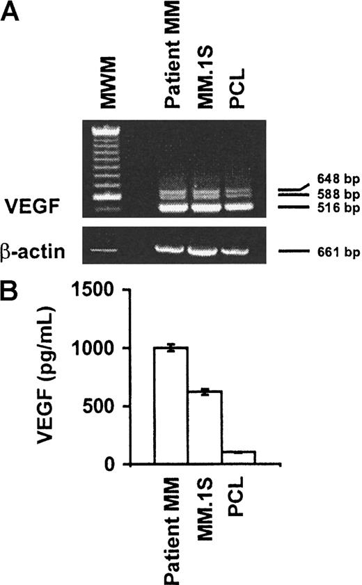Fig. 1. Expression and secretion of VEGF isoforms in MM.1S, patient MM, and patient PCL cells. / (A) MM.1S, patient MM, and patient PCL cells express VEGF. Equal amounts of RNA were reverse transcribed to generate cDNA, which was subjected to VEGF-specific PCR amplification by means of paired primers as described in “Materials and methods.” Three splice variants coding for the secreted isoforms VEGF121 (516 bp), VEGF145 (588 bp), and VEGF165 (648 bp) were amplified from all cells. The quality of RNA was confirmed by RT-PCR amplification of β-actin. MWM indicates molecular weight marker. (B) MM.1S, patient MM cells, and patient PCL cells secrete VEGF. Supernatants from equal numbers of cells (1 × 106) were collected after 48 hours and analyzed for VEGF protein by ELISA.