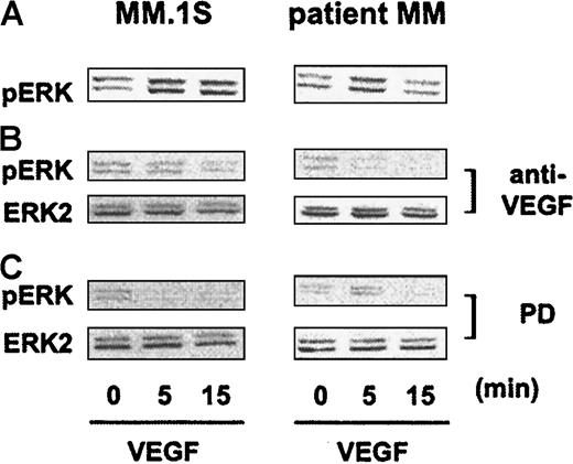 Fig. 5. Inhibition of VEGF-triggered ERK activation by blockade of VEGF and MEK-1. / MM.1S and patient MM cells pretreated as described in Figure 4A were either stimulated with 100 ng/mL VEGF165 alone (panel A) or treated for 30 minutes with 30 μg/mL anti–human VEGF antibody (anti-VEGF) (panel B) or for 1 hour with 50 μM PD89059 (panel C) prior to VEGF stimulation. Cells were solubilized, and whole cell lysates (40 μg) were analyzed by Western blotting with antisera against dually phosphorylated MAPK (ERK-1, ERK-2). Equal loading was confirmed by immunoblotting the membranes with antisera against ERK-2.