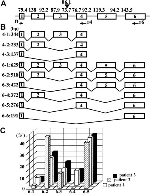 Fig. 3. Estimation and analysis of alternatively spliced products. / Alignment of exons 1 to 6 and the matching scores (A), molecular sizes of different construction of exons 1 to 6 (B), and splicing pattern change after IFN-γ treatment (C). In panel C, each spliced band in Figure 6C was quantified using a densitometer, and each relative value is presented as a column.