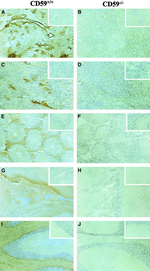 Fig. 3. Immunohistochemistry of tissue sections from CD59+/+ and CD59−/− mice. / All sections were labeled with a biotinylated anti-CD59 mAb followed by peroxidase-conjugated extra-avidin (Sigma), using DAB substrate and then counterstained with hematoxylin. The inserts show control sections that underwent the same procedure but without the mAb being present. The tissues represented are (A,B) kidney, (C,D) spleen, (E,F) testis, (G,H) brain (sagittal section through lateral ventricle), and (I,J) cerebellum. Magnification ×20 for all plates.