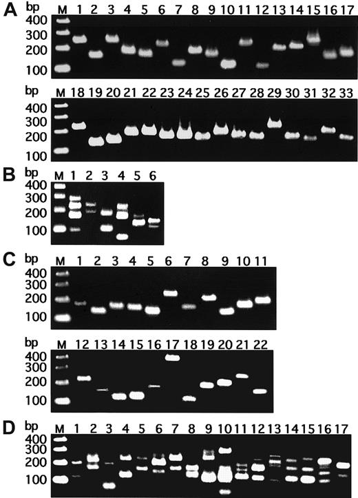 Fig. 1. Agarose gel electrophoresis of positive samples. / The nested PCR was performed as described in “Study design,” and the PCR products were loaded on a 2% agarose electrophoresis gel containing ethidium bromide and visualized under UV light. (A) Japanese samples showing a single band (lanes 1-33). (B) Japanese samples showing multiple bands (lanes 1-6). (C) German samples showing a single band (lanes 1-22). (D) German samples showing multiple bands (lanes 1-17). Lane M shows 100-bp ladder markers.