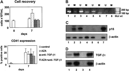 Fig. 2. Role of p15 and TGF-β1 in myelodysplastic megakaryocytic differentiation. / (A) On day 7 the cell output in the MDS cultures was comparable to the cell output in the normal CD34+ cultures. In contrast, the proportion of CD41-expressing cells was significantly lower. These findings were not modified by AZA or by anti–TGF-β1 antibody. (B) p15 Amplification bands were detectable in the presence of unmethylated and methylated sequence-specific primer pairs in CD34+cells (lanes 1 and 2) and in day 7 CD41+ cells (lanes 3 and 4). On the contrary, in CD41+ cells cultured in the presence of AZA, p15 amplification bands were detectable only in the presence of unmethylated sequence-specific primer pairs (lanes 5 and 6). Lanes 7 and 8 show negative controls. U indicates unmethylated; M, methylated. (C) Semiquantitative RT-PCR analysis of p15 mRNA expression showed that p15 was not expressed in CD34+ cells (lane 1), was expressed after 7 day culture in CD41+ cells (lane 2, p15/β-actin ratio 0.4), and was strongly up-regulated in CD41+ cells treated with AZA (lane 3, p15/β-actin ratio 1). Neutralizing anti–TGF-β1 antibody abrogated p15 expression both in control (lane 4) and in demethylated (lane 5) CD41+cells. Negative and positive controls are shown in lanes 6 and 7, respectively. (D) Semiquantitative RT-PCR analysis of TGF-β1 mRNA expression demonstrated the increase of TGF-β1 during megakaryocytic differentiation. TGF-β1/β-actin ratios are 0.4 in CD34+cells (lane 1) and 0.95 in CD41+ cells on day 7 (lane 2). Negative and positive controls are shown in lanes 3 and 4, respectively.
