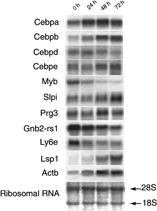 Fig. 4. Northern blot analysis of selected mRNAs. / Equivalent amounts of RNA from MPRO cells induced by ATRA at different time points (0 hour, 24 hours, 48 hours, and 72 hours) were resolved by formaldehyde-agarose gel electrophoresis, stained to verify the amount of loading. Eleven genes were separately probed on the RNA filters. The gene symbol of each probe was listed at the left of a related Northern blot result. Detailed information on these 11 probes was listed in Table 5. One of the RNA-blotted membrane photographs is shown with methylene blue–stained 28S and 18S RNA subunits demonstrating the quality and quantity of RNA loaded in individual lanes.