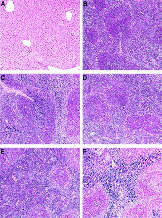 Fig. 1. Iron stain in spleen and liver in wild-type and heterozygous. / Fth+/− mice. Perls Prussian blue staining of liver (panel A) or spleen (panels B-F) from wild-type (panels A-C) or heterozygous (panels D-F) animals. Animals were analyzed at 6 weeks (panels B,D), 10 weeks (panel E), or 25 weeks (panels A,C,F) after birth. In both genotypes, there is a progressive iron loading of the spleen red pulp, with very few blue deposits in the white pulp, whereas there is no stainable iron in the liver (× 100).