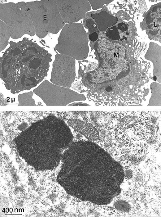 Fig. 2. Electron microscopy of spleen from a. / Fth+/− mouse. (A) At this low magnification, several spleen cells are visible, such as macrophage (M), lymphocyte (L), neutrophil (N), and erythrocyte (E). Arrows indicate electron-dense intracytoplasmic vesicles likely to contain iron (× 4000). (B) Higher magnification of 2 macrophage intracytoplasmic vesicles, showing typical paracrystalline arrangements of iron deposits (no counterstaining, × 20 000).