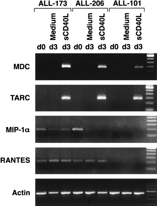 Fig. 1. CD40 cross-linking of leukemia cells induces the expression of mRNA for the chemokines MDC and TARC. / CD19+ leukemia cells were sorted using a high-speed sorter to obtain near 100% purity. Three representative patients, of 18 tested, are shown. Tumor cells were cultured in AIM V medium in the presence or absence of sCD40L, for 3 days.