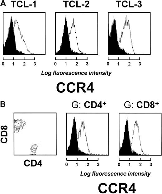 Fig. 5. Antitumor-specific autologous T cells express CCR4. / (A) Data represents T-cell lines (TCL) from 3 representative patients, of 5 tested. (B) Both CD4+ and CD8+ T cells express CCR4. Fluorescence intensity is shown on the x-axis. Blank areas represent fluorescence distribution of the molecules indicated and filled areas represent that of isotype-matched control antibodies. The cell number is shown on the y-axis.