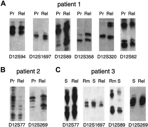Fig. 2. Detection of LOH on chromosome 12p by microsatellite marker mapping. / Allotypes at informative (heterozygous) markers are shown for each patient at presentation (Pr) and relapse (Rel). (A) Patient 1 (late relapse) retains heterozygosity at markers D12S94 and D12S62 but shows LOH (markers D12S1697, D12S89, D12S358, and D12S320) at presentation but not at relapse. (B) Patient 2 (late relapse) shows LOH of marker D12S77 at relapse but not at presentation and LOH of marker D12S269 at presentation but not at relapse. (C) Patient 3 (early relapse) cells at presentation were FACS sorted (S) and show heterozygosity at markers D12S77 and D12S269, as does relapse DNA. Sorted cells at presentation show microsatellite instability in D12S1697 with the appearance of an extra band not present in remission (Rm) and further show LOH at relapse. Marker D12S89 is heterozygous in remission but shows LOH at presentation (S).