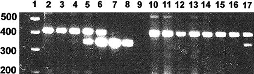 Fig. 2. PCR assay of provirus. / Genomic DNA was isolated from tissue samples and subjected to PCR using EPO-specific primers. PCR products were separated on a 2% agarose gel and stained with ethidium bromide. Shown is a PCR on negative control rat DNA in which increasing amounts of vector plasmid DNA were added. We established that the presence of 1% vector DNA could be detected by this method. Shown are assays of representative tissue DNA samples from a rat with an hematocrit of 74% killed 14 months after injection of EPO virus. Lane 1, molecular weight marker; lane 2, genomic DNA; lane 3, genomic DNA + 0.1% vector; lane 4, genomic DNA + 1% vector; lane 5, genomic DNA + 10% vector; lane 6, genomic DNA + 100% vector; lane 7, genomic DNA + 1000% vector; lane 8, vector; lane 9, water; lane 10, lung; lane 11, kidney; lane 12, liver; lane 13, spleen; lanes 14 to 17, muscle samples.