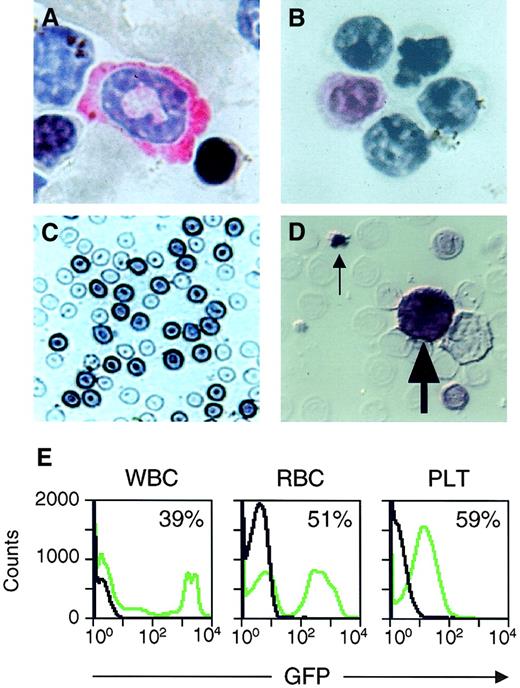 Fig. 3. Analysis of transgene expression in peripheral blood cells. / (A-D) Photomicrographs of circulating peripheral blood cells from transplant recipients expressing CGPMAPΔBel-encoded AP. Staining with Vector Red and hematoxylin shows an AP+ neutrophil (A) and an AP+ lymphocyte (B) with pink-stained cytoplasm. Staining with X-Phos shows darkly stained AP+ RBCs (C) and an AP+ WBC (large arrow) and AP+ platelet (small arrow) present in a smear examined by Nomarski microscopy (D). Original magnification 400 × in panels A-D. (E) Examples of flow cytometry data from the peripheral blood of a transplant recipient expressing CGPMscvF-encoded GFP (green lines) and an untransduced control animal (black lines), with the percentage of GFP+ cells indicated.