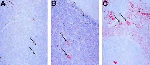 Fig. 6. Immunohistochemical localization of PF4. / Spleens were stained with the monoclonal anti-PF4 RTO as the primary antibody. Each spleen was counterstained with hemotoxylin. Panel A represents immunohistochemical studies of the spleen from a wild-type mouse, whereas panel B is from a 10 copy PF4-Only mouse, and panel C is from a 21 copy λ-PBP/PF4 mouse. The arrows point to some, but not all, of the megakaryocytes in each field. Original magnification 20 ×.