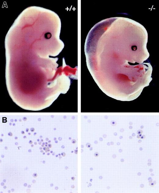Fig. 2. Gross and microscopic features of anemia in Pbx1−/− embryos. / (A) Appearance of wt (+/+) and Pbx1−/− embryos at E14.5. (B) Cytospins of peripheral blood showing nucleated and nonnucleated erythrocytes in circulation at E15. Equivalent numbers of cells were spun down for each sample.
