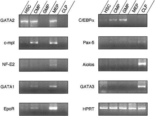 Fig. 5. Differential expression of transcription factors in fetal hematopoietic progenitors. / Semiquantitative RT-PCR was performed for a number of genes previously associated with the development of specific lineages.