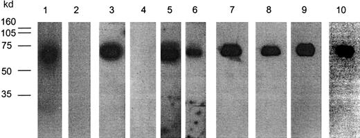Fig. 6. Binding of anti-GPIb mAbs to peptides displayed on phage proteins after SDS-denaturation and Western blotting. / mAb 27A10 (1, 2), mAb 12G1 (3, 4), mAb 12E4 (5, 6), mAb 6B4/clone D3 from the C7 library (7, 8), mAb 6B4/clone E1 from L15 library (9,10). Phages (2 × 1010) were run on SDS-PAGE (10% gel) either under nonreducing (lanes 1, 3, 5, 7, 9) or reducing (lanes 2, 4, 6, 8, 10) conditions, transferred to nitrocellulose membranes, and next probed with respective bmAbs. Detection occurred after incubation with streptavidin-HRP using enhanced chemiluminescence. mAbs 27A10, 12E4, and 12G1 recognized their phages under nonreducing, but not under reducing, conditions except for mAb 12E4. All phages selected on mAb 6B4 could be detected both under nonreducing and reducing conditions. Molecular weight (MW) marker is indicated.