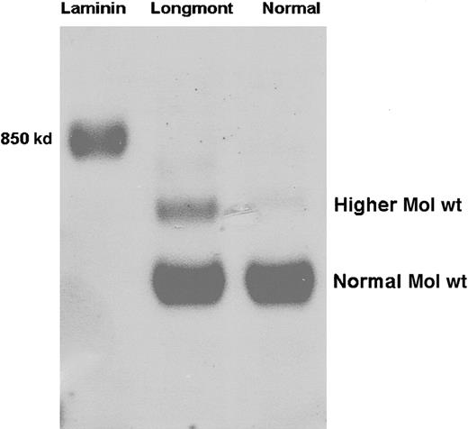 Fig. 1. Identification of a higher Mol wt species in fibrinogen Longmont. / Normal fibrinogen and fibrinogen Longmont along with mouse laminin were analyzed on 2% SDS-agarose gel. The gel was stained with Coomassie brilliant blue. Normal Mol wt and the higher Mol wt species are indicated.