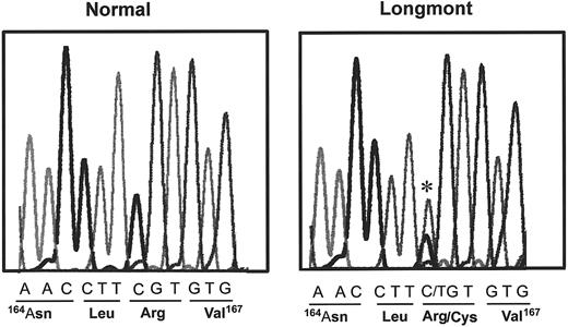 Fig. 4. Identification of a substitution in the Bβ chain gene of the proband. / DNA sequence of a part of the exon IV of the Bβ fibrinogen gene of the proband and a control. The mutation is indicated by a star, and the corresponding amino acid sequence of normal and the proband are indicated underneath the DNA sequences.