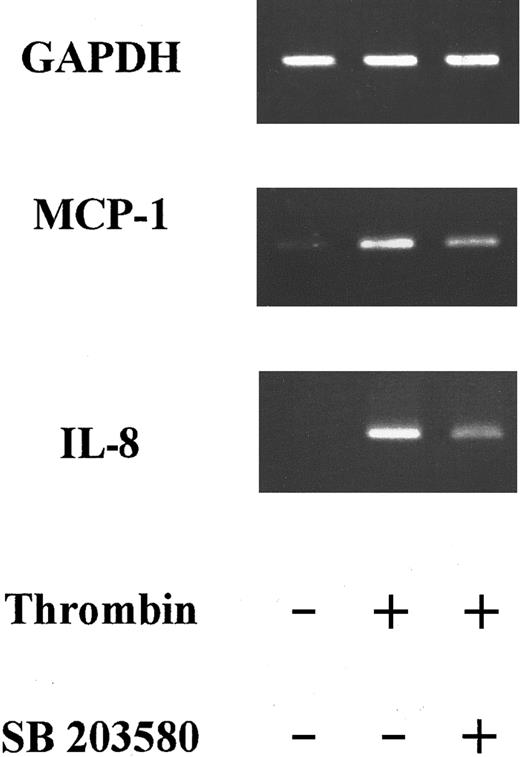 Fig. 7. Effects of SB203580 on thrombin-induced IL-8 and MCP-1 steady-state mRNA levels. / PCR products of RNA prepared from HUVECs stimulated with thrombin (8 U/mL) for 6 hours in the absence or presence of 2 μM SB203580 were deposited on a 2% agarose gel. SB203580 decreased IL-8 mRNA steady-state levels by almost 50% and MCP-1 mRNA by 36% (1 experiment representative of 3).