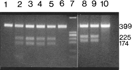 Fig. 3. Restriction enzyme analysis of exon 52 PCR products from affected members of families 1 and 2. / ScaI-restricted PCR products of patients F1-P1, F1-P2, F1-P3, F1-P4 (lanes 2 to 5) and a healthy person (lane 6). Lanes 8 and 9 contain the SacI-digested PCR products from 2 affected members of family 2 (F2-P1-and F2-P2). Lanes 1 and 10 contain unrestricted PCR products from F1-P1 and F2-P2. Amino acid substitutions of the 2 mutations in exon 52 create a newScaI and SacI restriction site, respectively, and the 399-bp PCR product is restricted to 225-bp and 174-bp fragments. All the patients show the 225-bp and 174-bp fragments in addition to a 399-bp PCR product, whereas the 2 normal samples show only the unrestricted 399-bp PCR product. Lane 7 contains the plasmid pBR322 digested with EcoRI and AvaII as a molecular-weight marker.