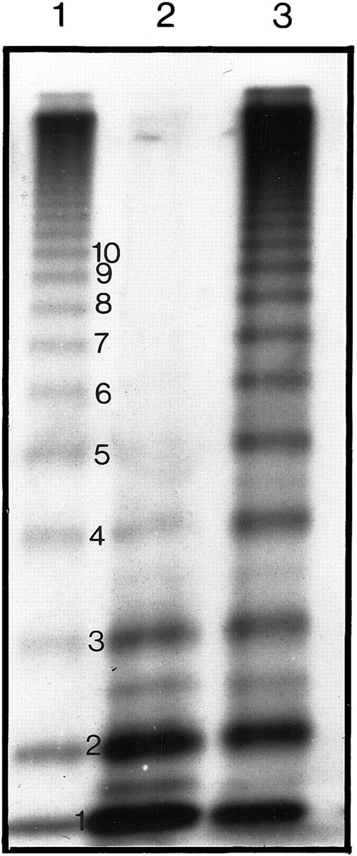 Fig. 5. Autoradiograph of the multimeric analysis of rVWF from COS-7 cells after cotransfection of WT and type IID vWF cDNA. / The autoradiograph shows rVWF samples electrophoresed in 1.4% SDS-agarose gel and visualized by autoradiography. Electrophoresis is from top to bottom and shows the high-, intermediate-, and low-molecular-weight multimers. rVWF from cells transfected with WT and IID cDNA are shown in lanes 1 and 2, respectively. Lane 3 shows rVWF from COS-7 cells transfected with both WT and IID cDNA.