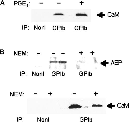 Fig. 3. Effect of PGE1 and NEM treatment on calmodulin association with GPIb-IX. / (A) Triton X-100 soluble fraction of platelets either untreated or treated with 3 nM PGE1 for 5 minutes at room temperature were immunoprecipitated by means of nonimmune sera (NonI) or GPIb antibodies and were immunoblotted by means of antibodies to calmodulin. (B) Triton X-100 soluble fractions of platelets either untreated or treated with 1 mM NEM for 5 minutes at room temperature were immunoprecipitated by means of nonimmune sera (NonI) or GPIb antibodies and were immunoblotted by means of antibodies to actin-binding protein (ABP, upper panel) or calmodulin (lower panel). Blots were visualized by means of a peroxidase-coupled second antibody and the ECL reagent. Results are representative of 3 separate experiments.