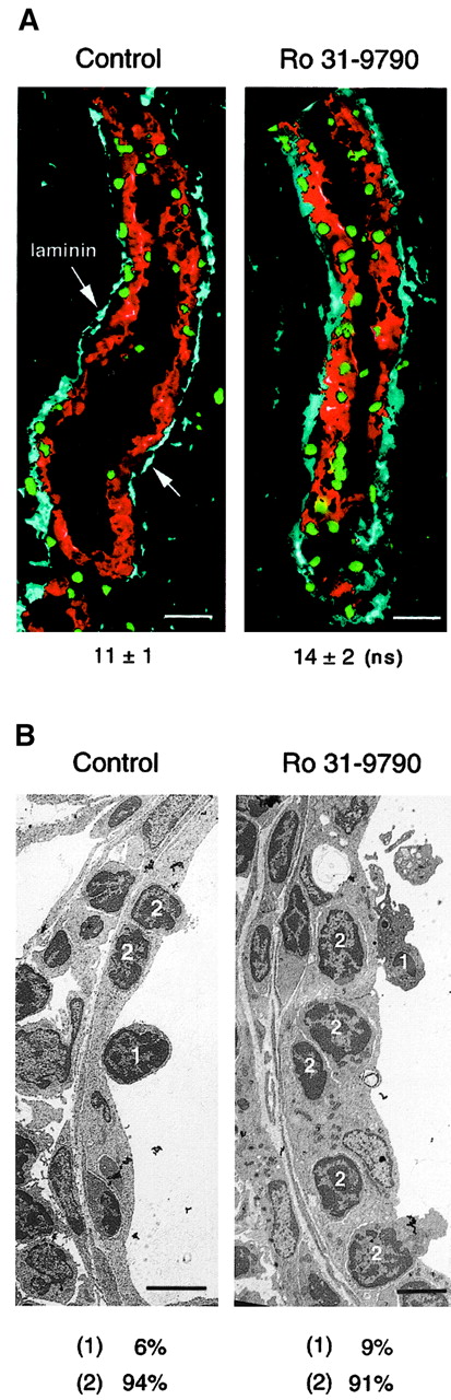 Fig. 4. Ro 31-9790 arrests lymphocytes in the endothelial lining and not in the basement membrane or the lumen of HEVs. / (A) Laminin in the HEV basement membrane was stained and the number of lymphocytes adjacent to or within the basement membrane counted and expressed per unit length of laminin. Although the number of CFSE-labeled cells inside HEVs was visibly increased in Ro 31-9790–treated mice, lymphocyte numbers in the basement membrane were not significantly different (ns). Bar indicates 20 μm. (B) Ultrastructural analysis of HEVs showed the majority of lymphocytes inside HEVs were within the endothelial lining (position 2) and were not attached to the luminal surface of HEVs (position 1). Other types of leukocytes were not seen binding or transmigrating HEVs. Results are percent of lymphocytes in positions 1 and 2 in transmission electron micrographs. A total of 85 to 115 lymphocytes were counted. LNs from perfused mice were fixed and cut and sections stained for transmission electron microscopy using standard techniques. Bar indicates 5 μm.