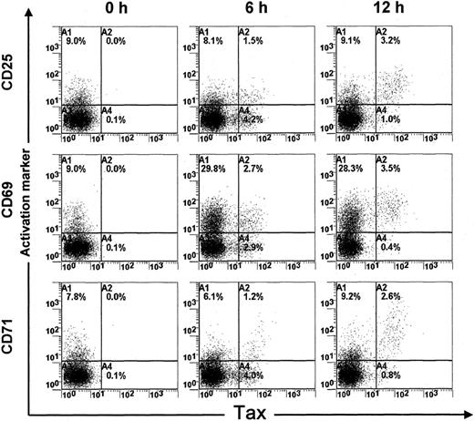 Fig. 1. Expression of activation markers (CD25, CD69, and CD71) in HTLV-I Tax+ PBMCs. PBMCs were isolated from an HTLV-I–infected individual (TAZ) and harvested directly or after 6 or 12 hours of cultivation in vitro. / One representative experiment of 16 is shown.