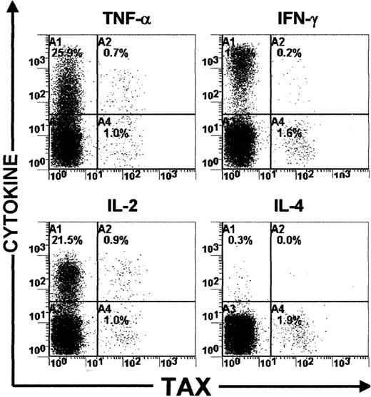 Fig. 3. Detection of IFN-γ, TNF, IL-2, and IL-4 expression in mitogen-activated PBMCs. / Dot plots showing both cytokine and HTLV-I Tax expressions in PBMCs isolated from one HTLV-I–infected individual (HS).