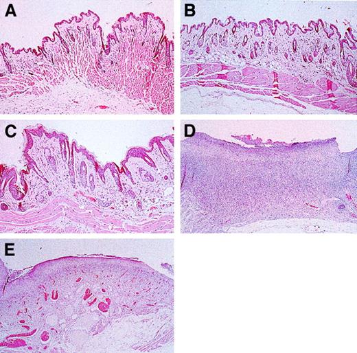 Fig. 7. Skin histological studies of triple-mutant, E/P double-mutant, and control mice. / Skin sections were obtained from the area of the neck where lesions formed (Figure 6). Cervical skin from wild-type (A) and L-selectin–deficient (B) mice was normal and without lesions. (C) Skin from 15-month-old E/L/P triple mutants was essentially normal. (D) Cervical skin from E/P double-mutant mice was diffusely ulcerated, with the surface colonized by bacteria and a mixed acute and chronic inflammatory infiltrate that disrupted the underlying dermis and pannicular skeletal muscle layer. (E) Section of an excoriative skin lesion representative of the lesions that developed in the 3 most severely affected triple-null mice. Lesions that formed in the few triple-null mice affected were much less severe than those common in the E/P double-mutant mice, with the underlying structural layers remaining intact (hematoxylin and eosin, original magnification × 200).